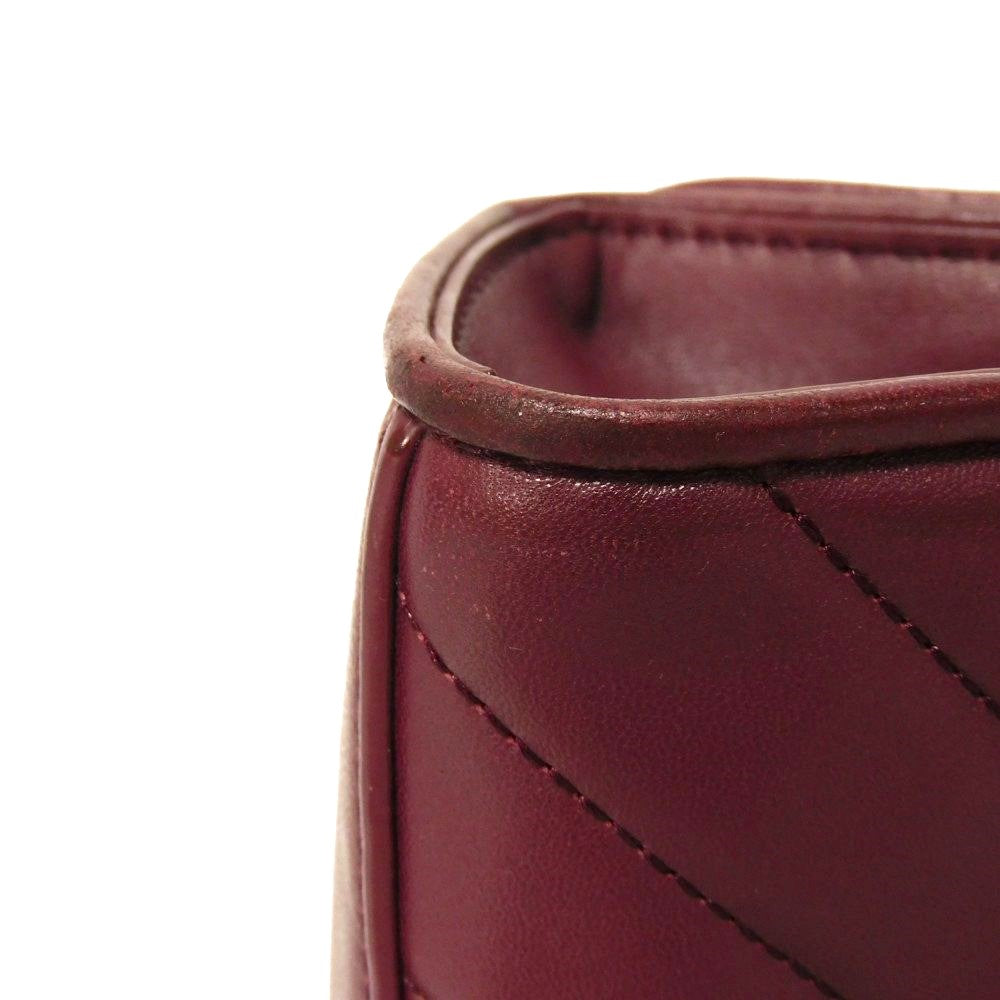 トリー バーチ アレクサ コンバーチブル ラムスキン ショルダー バッグ